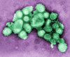 Schweinegrippe-virus-web